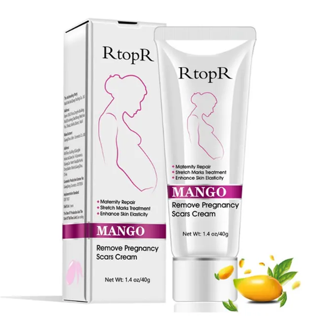 Natural Mild Non irritating Mango Remove Stretch Mark Cream For Pregnancy Repair Scar Slack Line Abdomen Stretch Marks Cream Default - Shop at LoveMi