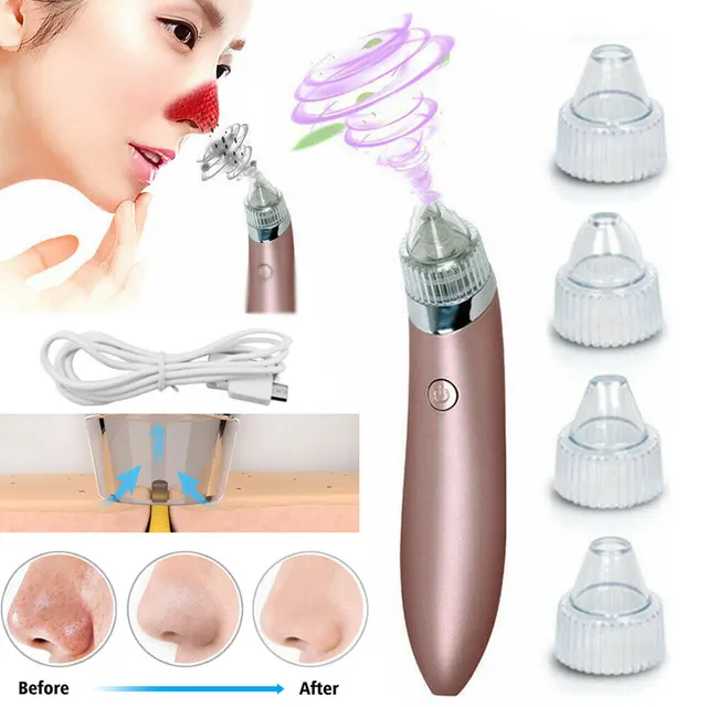 Electric Blackhead Vacuum Pore Cleaner Acne Pimple Remover Strong Suction Tool Electric Blackhead Remover Pore Vacuum Suction Diamond Dermabrasion ... As Picture - Shop at LoveMi