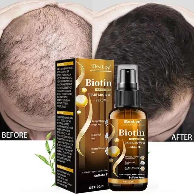 Anti Hair Loss Hair Nourishing Liquid Hair Firming And Hair Increasing 20Ml - Shop at LoveMi