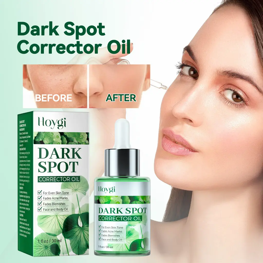 Hoygi Dark Spot Correction Serum Lightened Face Spots, Sun Spots, Brightened Elbow Joints, Tenderized Skin And Even Skin Tone - 30Ml